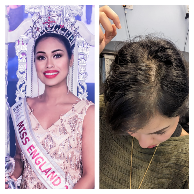 Miss England 2024 Secures Watermans Hair Growth as Premier Sponsor